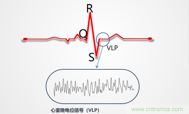 解決心電監測行業難題，曼森伯格的濾波技術獲國家知識產權局發明授權